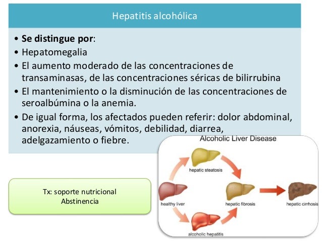 Como hacer que la persona ha dejado a beber el alcohol