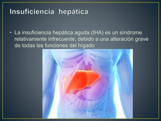 • La insuficiencia hepática aguda (IHA) es un síndrome
relativamente infrecuente, debido a una alteración grave
de todas las funciones del hígado
 