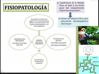 ANEMIA
APLASICA
ADQUIRIDA
Secundaria al efecto de
agentes con capacidad para
dañar a los precursores del
tejido hematopoyético o al
microambiente
Predisposición
genética
FACTORES RACIALES
FACTORES EXTERNOS
Insecticidas y
fertilizantes
químicos
PRESENCIA DE
ANTIGENOS
HLA-DR2, HLA-DR4,
HLA-Pw3
FISIOPATOLOGÍA
 