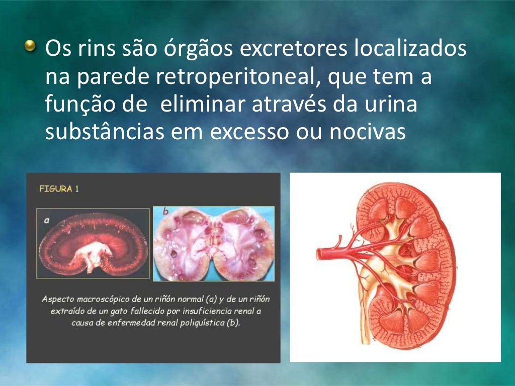 Insuficiencia Renal Aguda e Crônica por Eduarda Gobbi