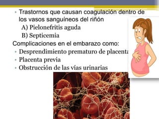 • Trastornos que causan coagulación dentro de
los vasos sanguíneos del riñón
A) Pielonefritis aguda
B) Septicemia
Complicaciones en el embarazo como:
• Desprendimiento prematuro de placenta
• Placenta previa
• Obstrucción de las vías urinarias
 