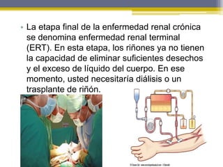 • La etapa final de la enfermedad renal crónica
se denomina enfermedad renal terminal
(ERT). En esta etapa, los riñones ya no tienen
la capacidad de eliminar suficientes desechos
y el exceso de líquido del cuerpo. En ese
momento, usted necesitaría diálisis o un
trasplante de riñón.
 