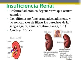 Insuficiencia Renal
• Enfermedad crónico degenerativa que ocurre
cuando:
• Los riñones no funcionan adecuadamente y
no son capaces de filtrar los desechos de la
sangre (sales, agua, creatinina urea, etc.)
• Aguda y Crónica
 