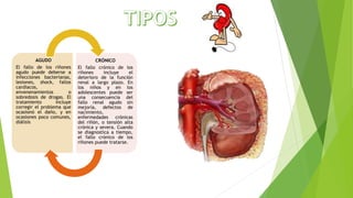 Insuficiencia renal | PPTX