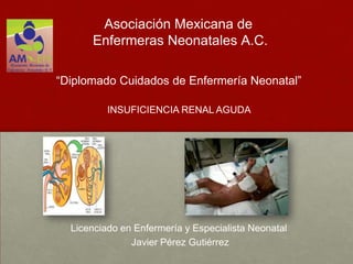 Asociación Mexicana de
      Enfermeras Neonatales A.C.

“Diplomado Cuidados de Enfermería Neonatal”

          INSUFICIENCIA RENAL AGUDA




  Licenciado en Enfermería y Especialista Neonatal
               Javier Pérez Gutiérrez
 