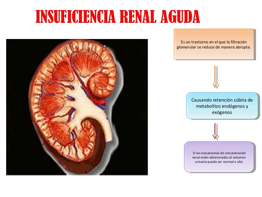 Insuficiencia renal aguda