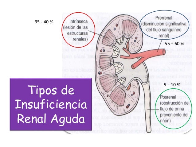 Insuficiencia renal aguda - I.R.A. Insuficiencia renal aguda - I.R.A.
