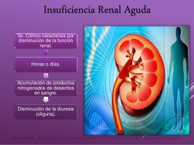 Insuficiencia renal aguda Insuficiencia renal aguda