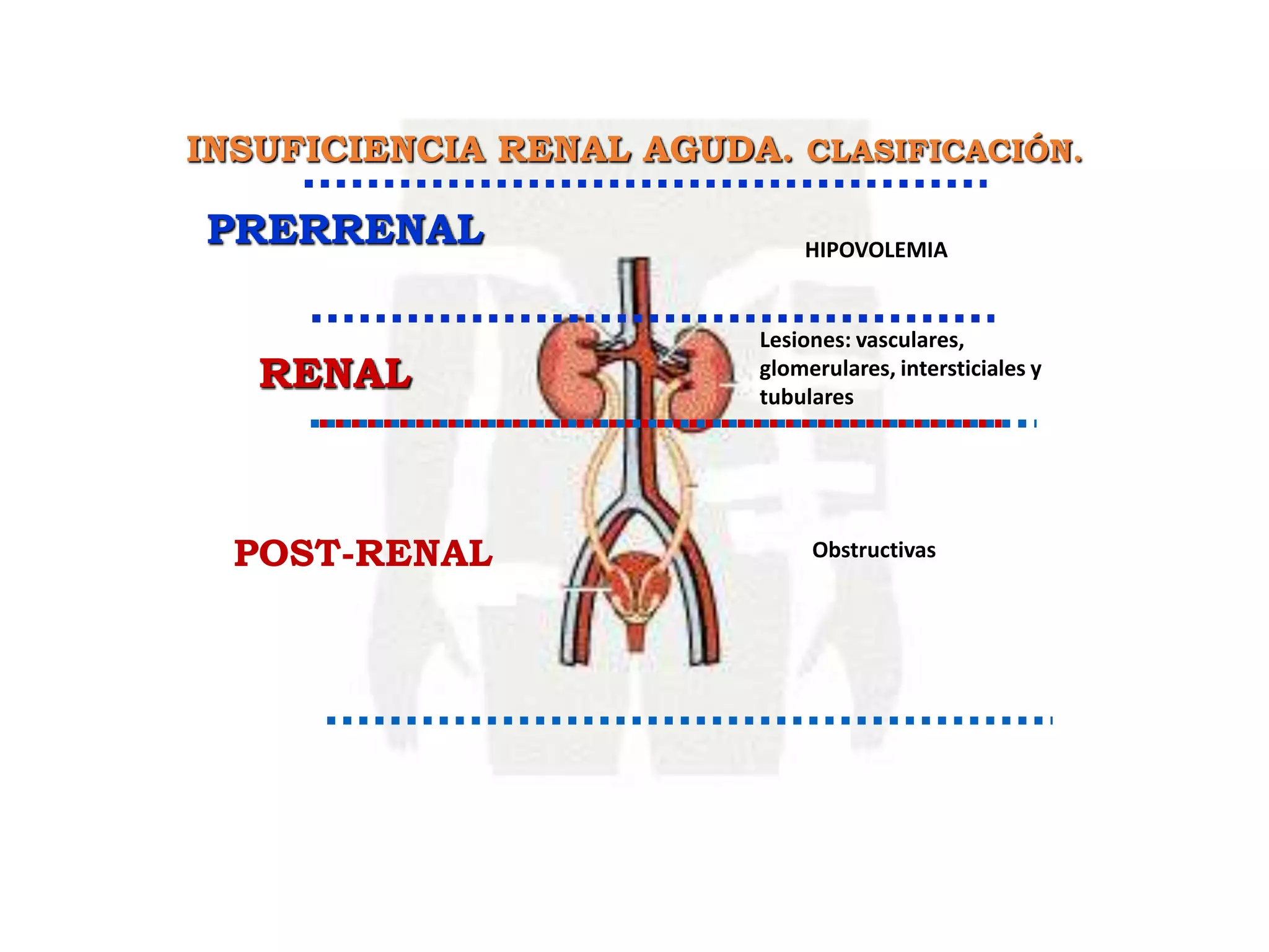 INSUFICIENCIA RENAL AGUDA.pptx