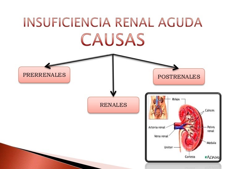 Insuficiencia renal aguda (ira) Insuficiencia renal aguda (ira)