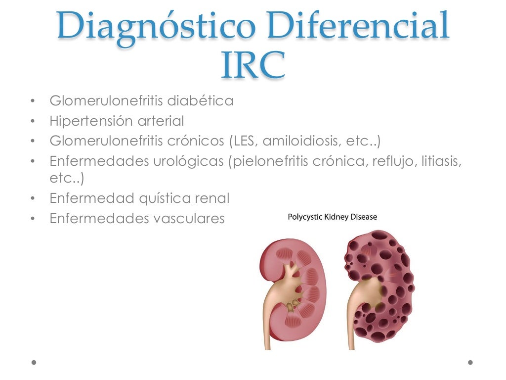 Insuficiencia renal aguda y cronica