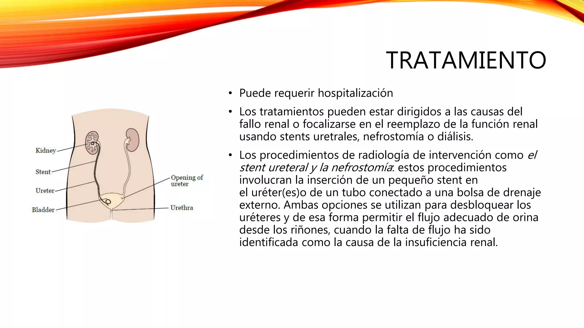Stents Rinones Insuficiencia renal cirugia | PPTX