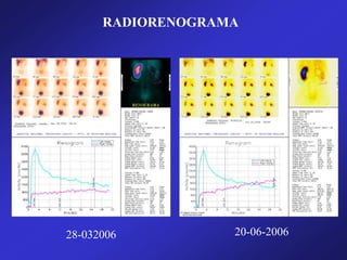 RADIORENOGRAMA
28-032006 20-06-2006
 
