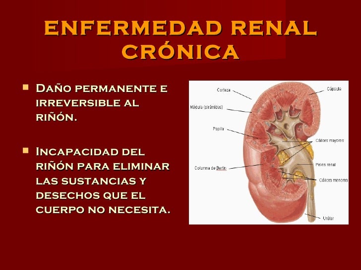 Insuficiencia renal cronica Insuficiencia renal cronica