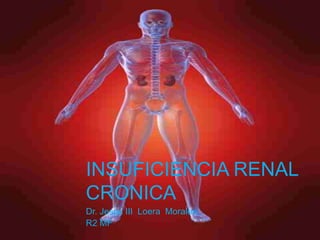 Insuficiencia Renal Cronica Dr. Jesus III  Loera  Morales R2 MF  