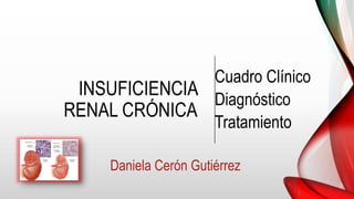 INSUFICIENCIA
RENAL CRÓNICA
Cuadro Clínico
Diagnóstico
Tratamiento
Daniela Cerón Gutiérrez
 
