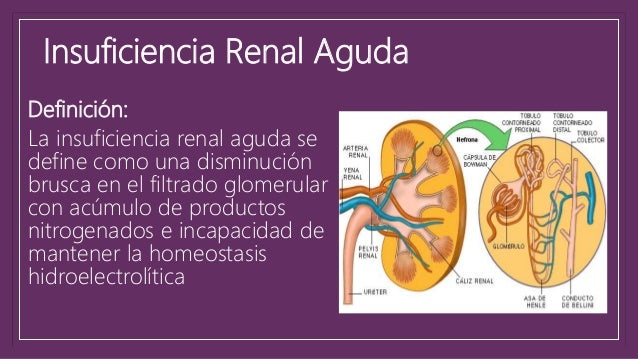 Insuficiencia Renal 2017