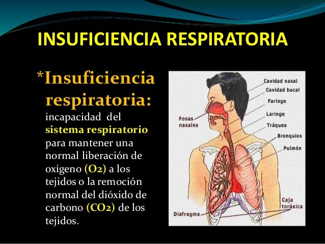 Insuficiencia respiratoria 2014