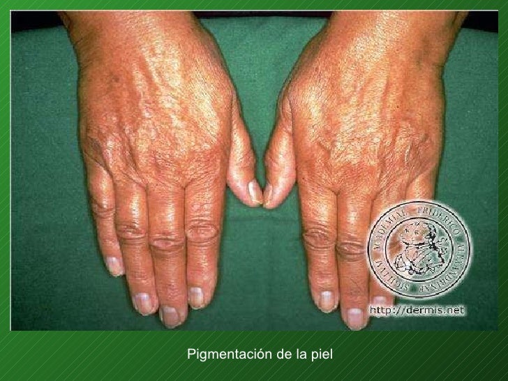 Que las coreanas blanquean la piel