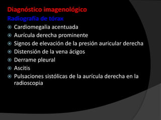 Diagnóstico imagenológico
Radiografía de tórax









Cardiomegalia acentuada
Aurícula derecha prominente
Signos de elevación de la presión auricular derecha
Distensión de la vena ácigos
Derrame pleural
Ascitis
Pulsaciones sistólicas de la aurícula derecha en la
radioscopia

 