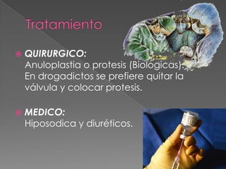    QUIRURGICO:
    Anuloplastia o protesis (Biologicas).
    En drogadictos se prefiere quitar la
    válvula y colocar protesis.

   MEDICO:
    Hiposodica y diuréticos.
 
