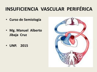 INSUFICIENCIA VASCULAR PERIFÉRICA
• Curso de Semiología
• Mg. Manuel Alberto
Jibaja Cruz
• UNP. 2015
 