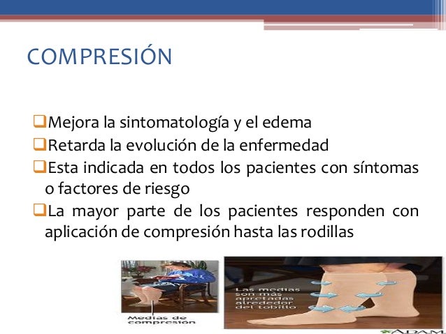 Como curar varikoz de las venas en los pies los medios públicos