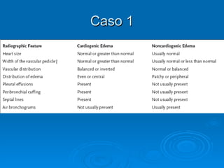 Caso 1 