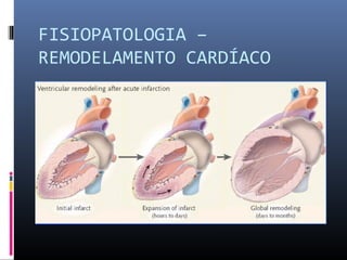 FISIOPATOLOGIA –
REMODELAMENTO CARDÍACO
 