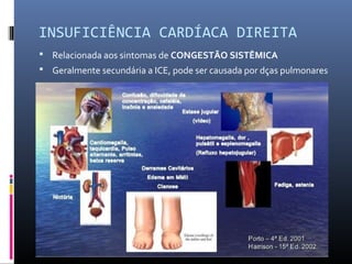 INSUFICIÊNCIA CARDÍACA DIREITA
 Relacionada aos sintomas de CONGESTÃO SISTÊMICA
 Geralmente secundária a ICE, pode ser causada por dças pulmonares
 