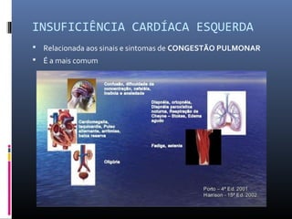 INSUFICIÊNCIA CARDÍACA ESQUERDA
 Relacionada aos sinais e sintomas de CONGESTÃO PULMONAR
 É a mais comum
 