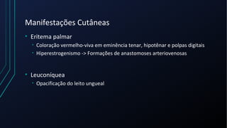 Manifestações Cutâneas
• Eritema palmar
• Coloração vermelho-viva em eminência tenar, hipotênar e polpas digitais
• Hiperestrogenismo -> Formações de anastomoses arteriovenosas
• Leuconíquea
• Opacificação do leito ungueal
 