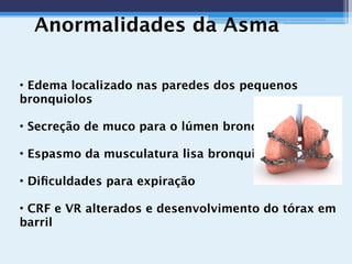 Anormalidades da Asma
• Edema localizado nas paredes dos pequenos
bronquiolos
• Secreção de muco para o lúmen bronquiolar
• Espasmo da musculatura lisa bronquiolar
• Diﬁculdades para expiração
• CRF e VR alterados e desenvolvimento do tórax em
barril
 