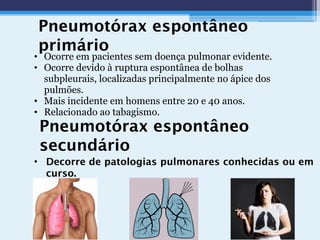 Pneumotórax espontâneo
primário
• Ocorre em pacientes sem doença pulmonar evidente.
• Ocorre devido à ruptura espontânea de bolhas
subpleurais, localizadas principalmente no ápice dos
pulmões.
• Mais incidente em homens entre 20 e 40 anos.
• Relacionado ao tabagismo.
Pneumotórax espontâneo
secundário
• Decorre de patologias pulmonares conhecidas ou em
curso.
 