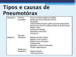 Tipos e causas de
Pneumotórax
 
