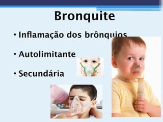 Bronquite
• Inﬂamação dos brônquios
• Autolimitante
• Secundária
 