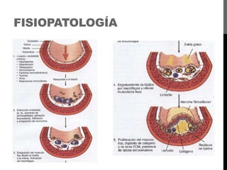 FISIOPATOLOGÍA

 