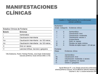 MANIFESTACIONES
CLÍNICAS

Villa Estebanez, Ruben; Rodrigo Pendas, Jose Angel, Enfermedad
vascular periferica, Guias clinicas 2002; 2 (16)

Aguila Marquez R. y col, Estado actual de la enfermedad
arterial periferica oclusiva, ACTA MÉDICA GRUPO ÁNGELES.
Volumen 5, No. 4, octubre-diciembre 2007

 