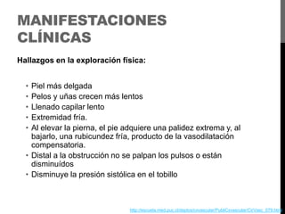 MANIFESTACIONES
CLÍNICAS
Hallazgos en la exploración física:
•
•
•
•
•

Piel más delgada
Pelos y uñas crecen más lentos
Llenado capilar lento
Extremidad fría.
Al elevar la pierna, el pie adquiere una palidez extrema y, al
bajarlo, una rubicundez fría, producto de la vasodilatación
compensatoria.
• Distal a la obstrucción no se palpan los pulsos o están
disminuídos
• Disminuye la presión sistólica en el tobillo

http://escuela.med.puc.cl/deptos/cxvascular/PubliCxvascular/CirVasc_079.html

 