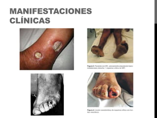 MANIFESTACIONES
CLÍNICAS

 