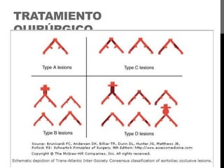 TRATAMIENTO
QUIRÚRGICO

 