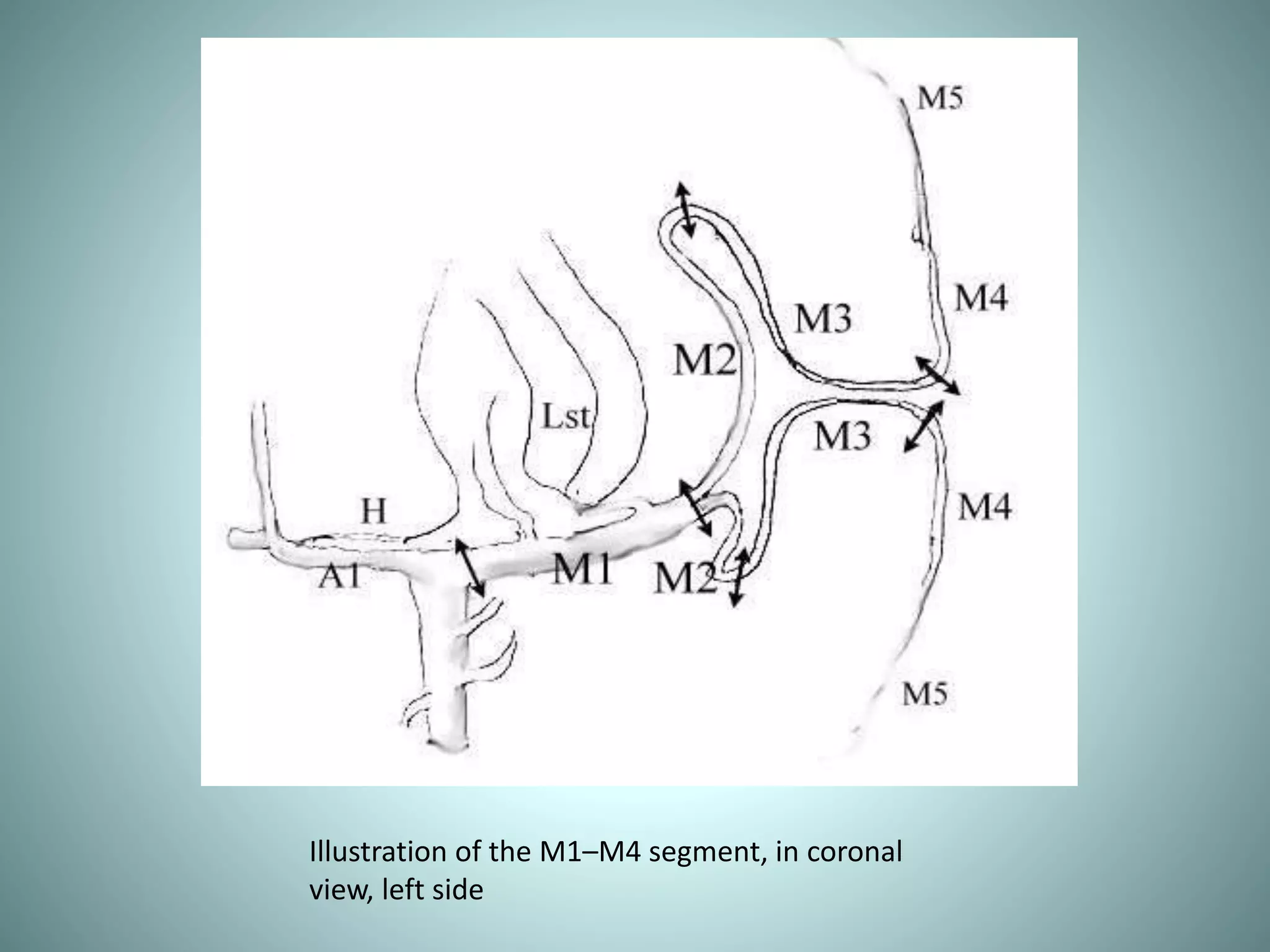 Illustration of the M1–M4 segment, in coronal
view, left side
 