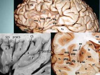 Insular Humunculus Insular lobe anatomy | PPTX