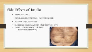 Insulin powerpoint presentation common knowledge | PPTX