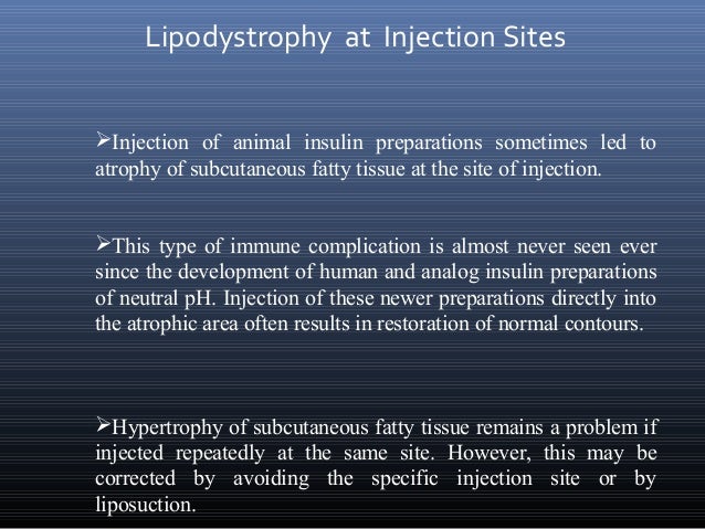 Insulin primary site