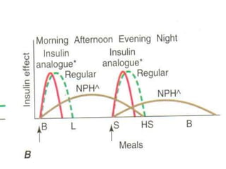 LevemirFlexPen = identified by green push button