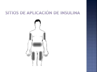 Insulinas