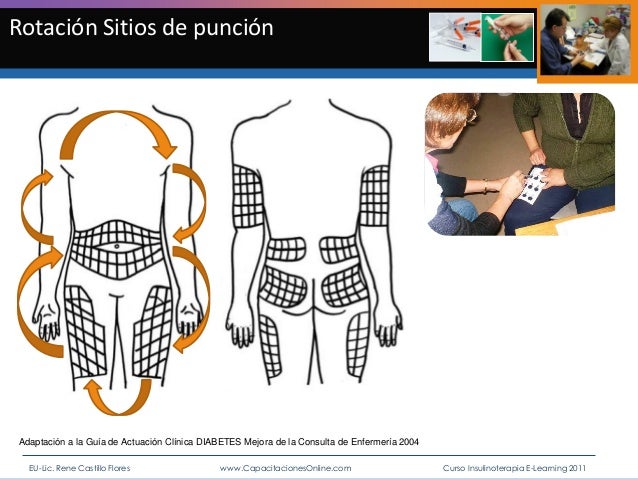 Insulina y enfermería. curso e learning insulinoterapia Insulina y enfermería. curso e learning insulinoterapia