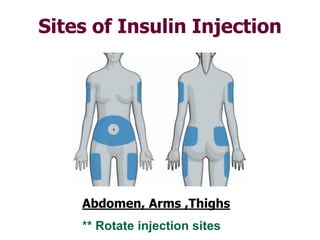 Insulin basics.p | PDF