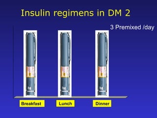 Insulin regimens in DM 2
Breakfast Lunch Dinner
3 Premixed /day
 